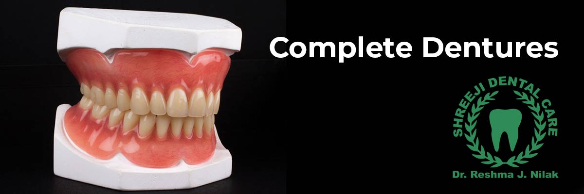 Complete Dentures