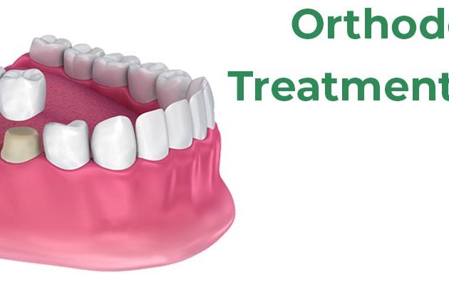 Fixed Teeth(Crown And Bridges)