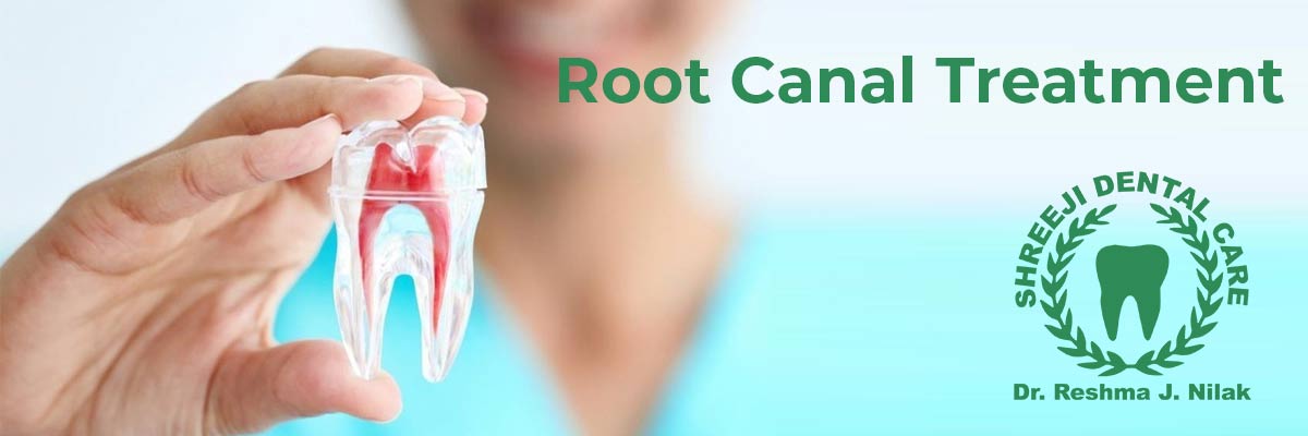 Root Canal Treatment - www.Shreejidentalcare.com